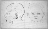 Vorschaubild von Physiognomiestudien eines Säuglings (Otto von Gerlach).