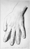 Vorschaubild von Die linke Hand des Johann Ehrentreu Teodor Licht.