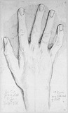 Vorschaubild von Die rechte Hand des (Riesen) Johann Carl Friedrich Licht.