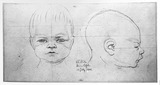 Vorschaubild von Kopf eines Säuglings ("der kleine Cassel").