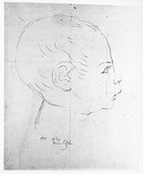 Vorschaubild von Säuglingskopf im Profil nach rechts, ("der kleine Cassel").